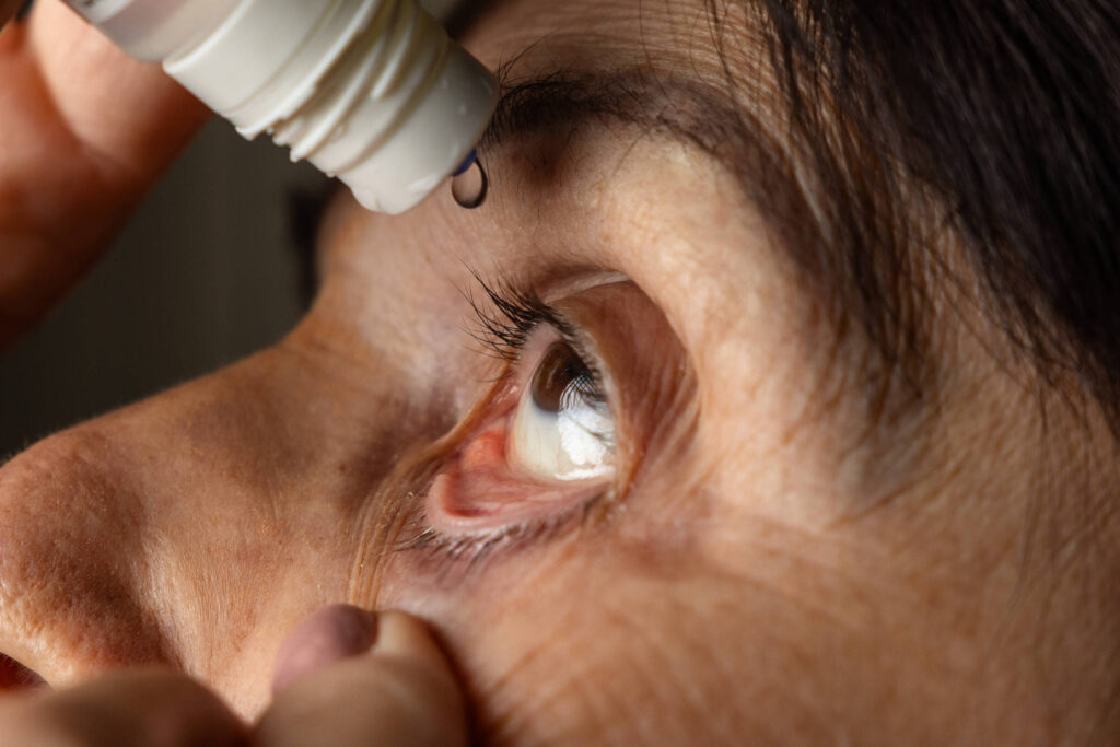 FDA aprova colírio que substitui óculos por até 10 horas – 20/08/2025 – Equilíbrio e Saúde